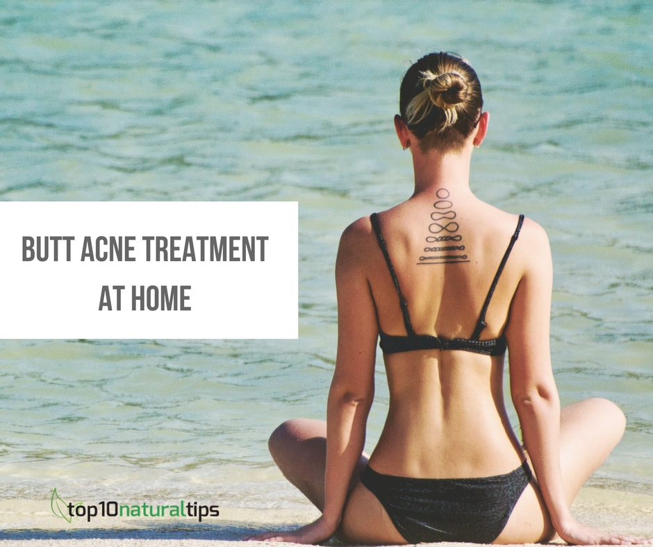 butt acne treatment at home