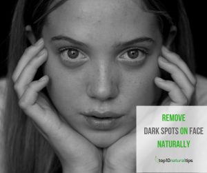 remove dark spots on face naturally