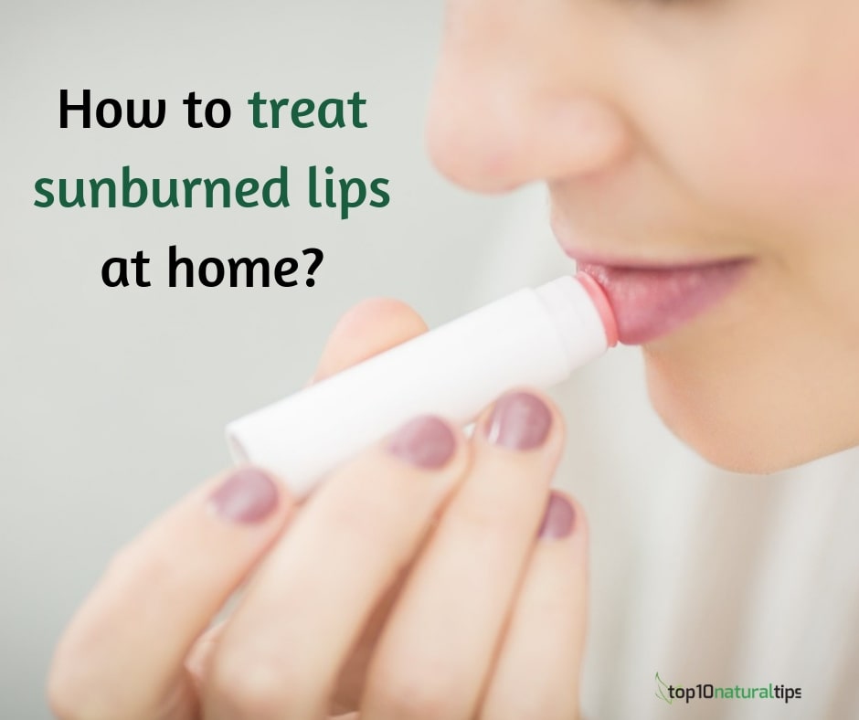 sunburned lips treatment