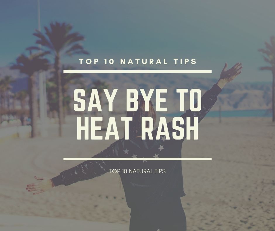 treat heat rash naturally